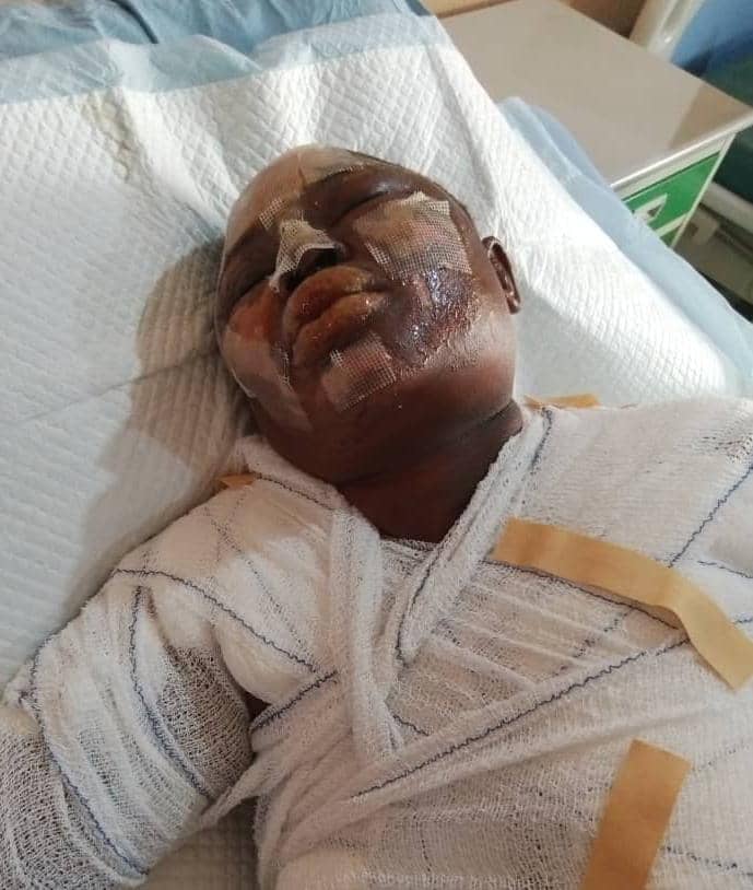 Oyo: Man Arrested for Setting Woman Ablaze Over Failed Relationship